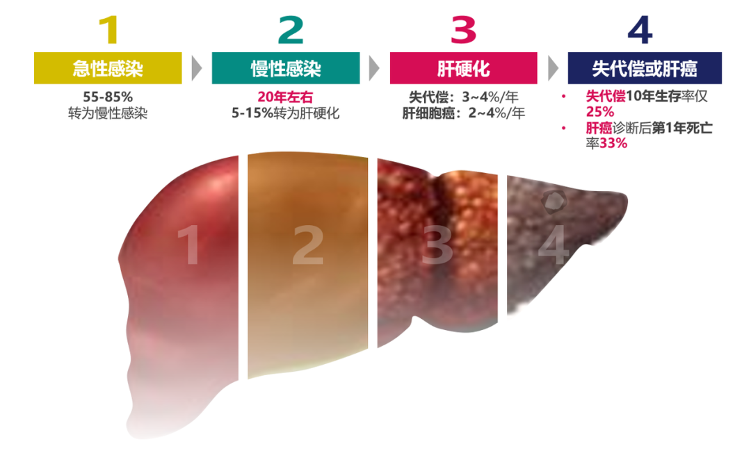 悄悄变成肝硬化、肝癌，很多人感染了却不知道